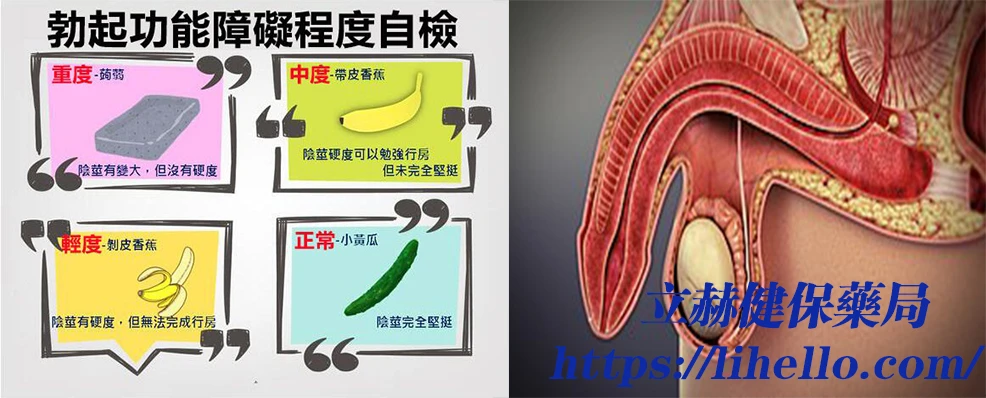 男性勃起功能障礙完整指南：症狀、成因與改善方式